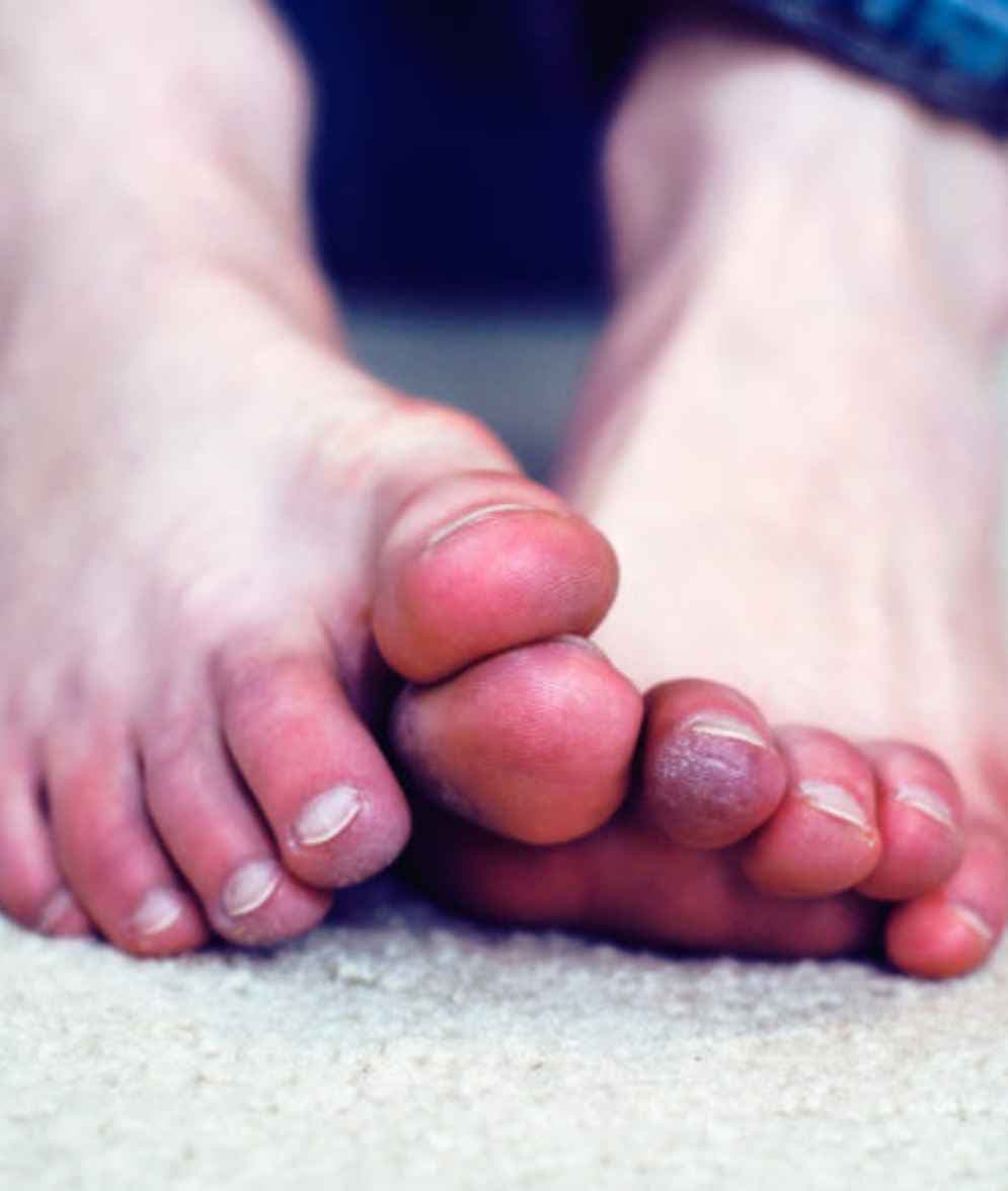 Winter Warriors Unite! Beat Frostbites Before they Bite: Tips & Tricks! 