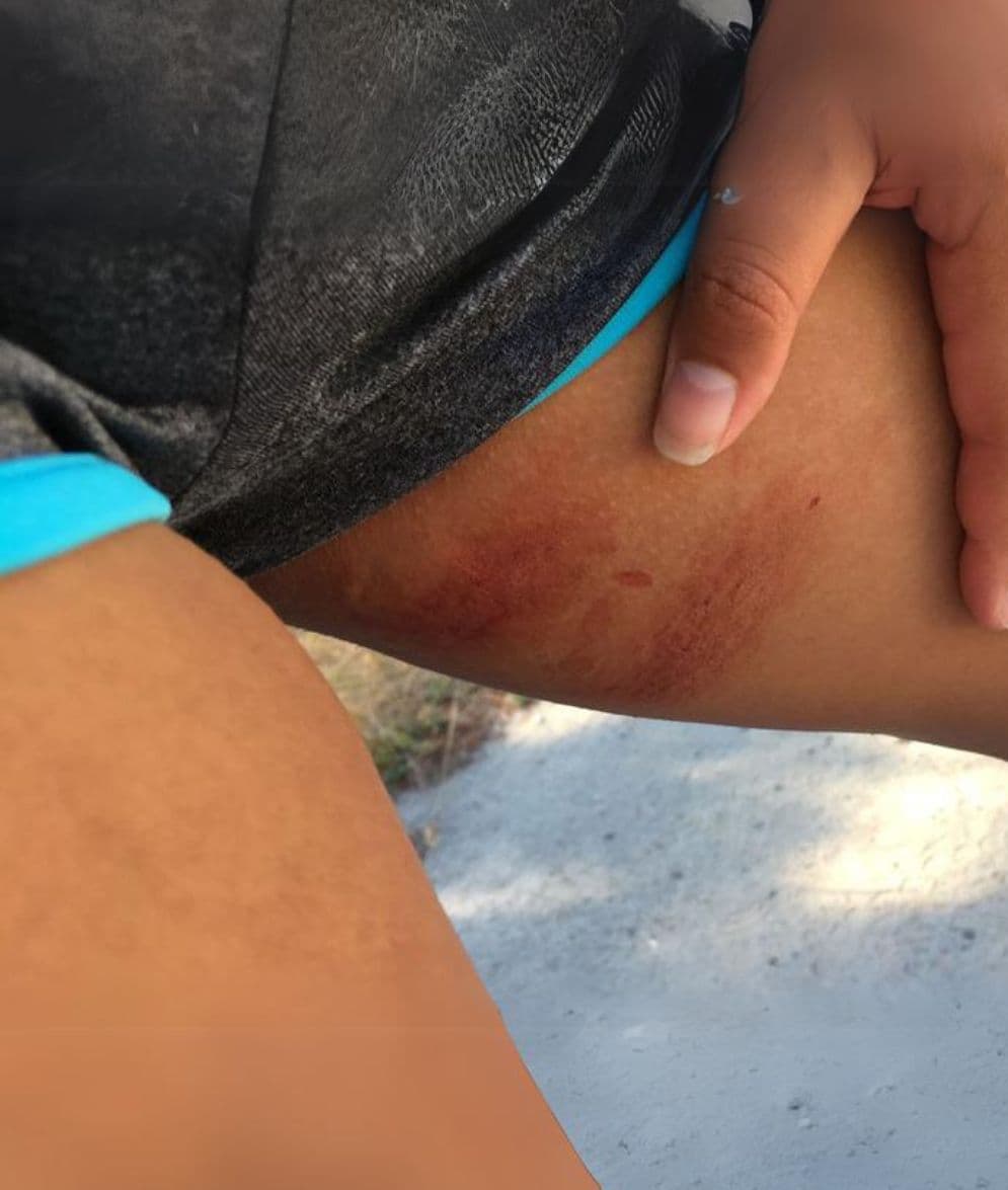 Why Cotton Isn't King: The Drawbacks of Cotton Clothing in Intense Outdoor Activities.